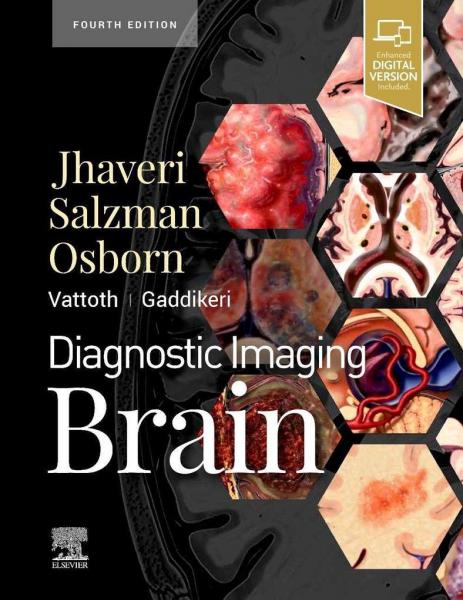 مغز با تصویربرداری تشخیصی - رادیولوژی